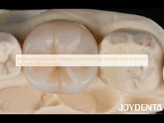 Multilayer Full Zirconia kết hợp tối ưu của sức mạnh và thẩm mỹ cho phục hồi răng