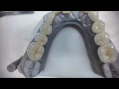 Răng giả zirconia mô phỏng răng thật