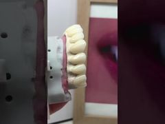 See Why Choose Zirconia dentures that imitate natural teeth