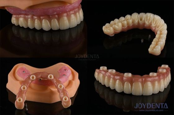 Mua Răng đa răng thay thế cấy ghép bề mặt thô Các thành phần giả sản xuất trực tuyến
