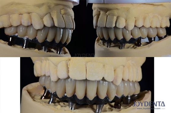 Mua Titanium đa răng cấy ghép răng giả Phẫu thuật ngoại vi kết nối hình lục giác sản xuất trực tuyến