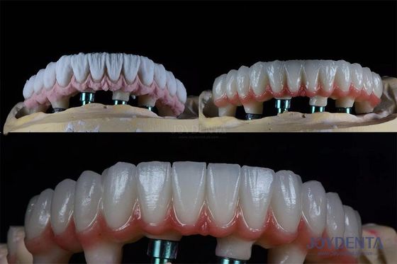 Mua Bộ cấy ghép răng hai giai đoạn 10mm đa răng cho vương miện giả nội xương sản xuất trực tuyến