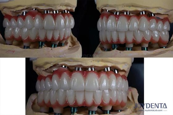 Mua 10mm Titanium đa răng cấy ghép bề mặt thô để phục hồi răng sản xuất trực tuyến