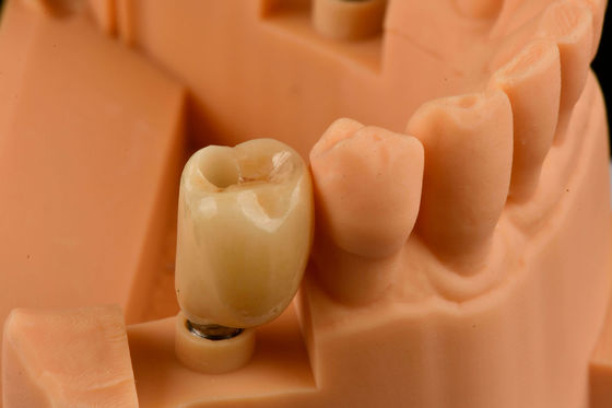 Mua Internal Hex Connection Sandblasted Titanium Dental Implants Thay răng đơn sản xuất trực tuyến