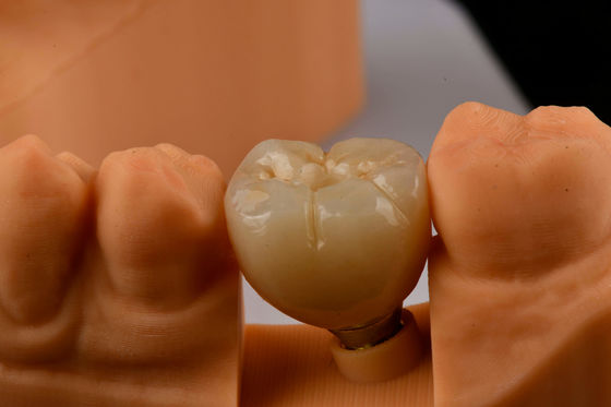 Mua Tiến sĩ cấy ghép răng miệng tự chạm vào cấy ghép răng một răng với kết nối hex bên trong sản xuất trực tuyến