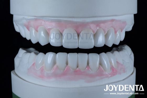 Mua Phục hồi răng rất chính xác Wax lên trong nha khoa Độ dày 1-2mm sản xuất trực tuyến