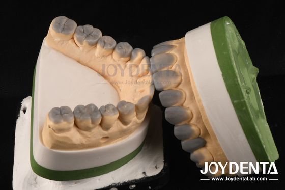 Mua Chất liệu có độ chính xác cao và có độ dày 1-2mm sản xuất trực tuyến