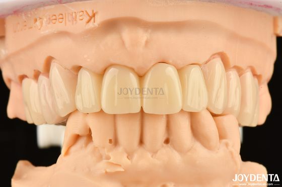 Mua PMMA M75 tương thích sinh học Khả năng phục hồi chống trầy xước Đối với thẩm mỹ nha khoa sản xuất trực tuyến