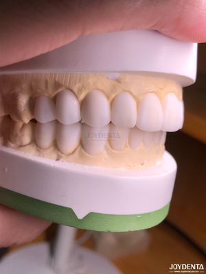 Mua Máy châm chẩn đoán kỹ thuật số tùy chỉnh để sao chép giải phẫu răng tự nhiên sản xuất trực tuyến