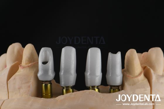 Mua Đồ cấy ghép nha khoa tùy chỉnh Abutment Zirconia cho phục hồi đơn vị đơn lẻ hoặc nhiều đơn vị sản xuất trực tuyến