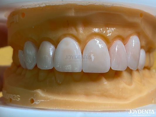 Mua Độ thấm cao Vỏ bề mặt tự nhiên Vỏ vỏ sứ Emax tùy chỉnh sản xuất trực tuyến