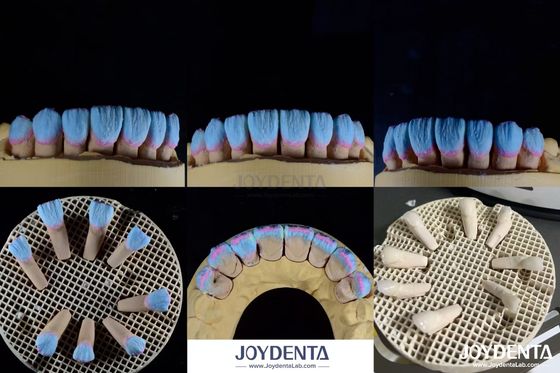 Mua Khả năng tương thích sinh học cao Feldspathic Ceramic Veneer Gloss For Dental Restorations sản xuất trực tuyến