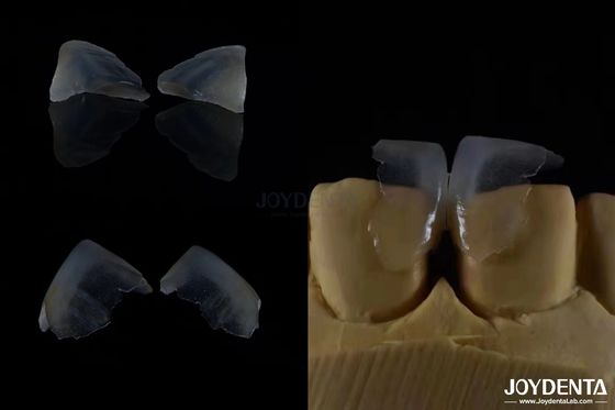 Mua Hình dáng tối thiểu xâm lấn mỹ phẩm Veneers nha khoa thủy tinh gốm Màu cực mỏng sản xuất trực tuyến