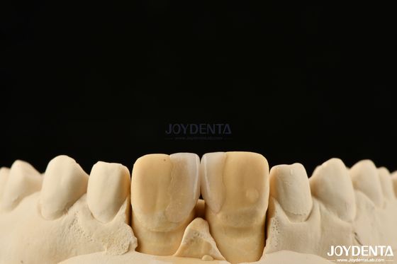 Mua 0.2mm Độ dày Microthin Veneers Glass Ceramic Dental Veneers cho răng trước sản xuất trực tuyến