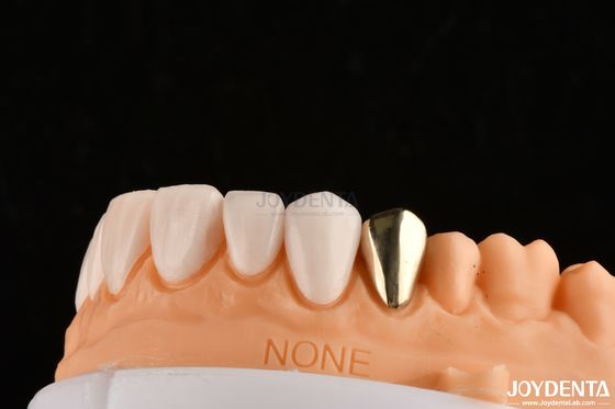 Mua Ultra Thin IPS Emax Press Veneers Veneer răng mỹ phẩm cho phục hồi phía trước phía sau sản xuất trực tuyến