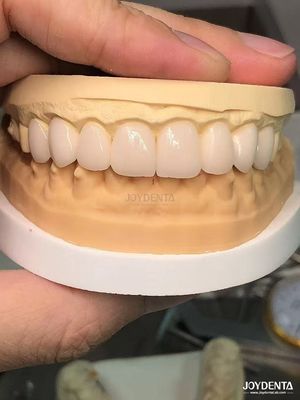 Mua 16 sắc thái Màu sắc Emax veneers nha khoa A1-A4 Kháng vết bẩn cao cho nụ cười hoàn hảo sản xuất trực tuyến