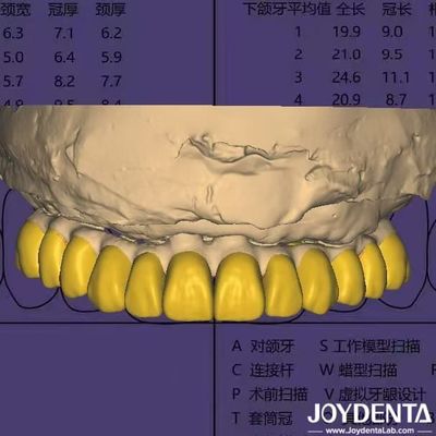 Mua Phần mềm thiết kế nha khoa Digital Wax Up với HIPAA tuân thủ bảo mật dữ liệu sản xuất trực tuyến
