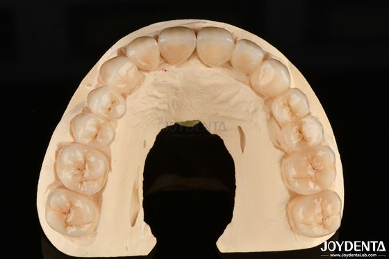 Mua Kháng ăn mòn cao Full Zirconia Vật liệu ưa thích cho việc phục hồi răng trắng sản xuất trực tuyến
