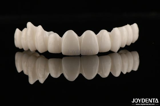 Mua Phong cách thẩm mỹ cao Full Zirconia Khả năng chống ăn mòn và mòn cao cho các ứng dụng đòi hỏi sản xuất trực tuyến