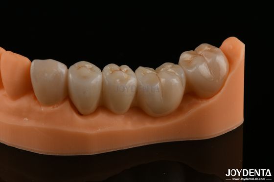 Mua Cải tạo răng chính xác Full Zirconia Độ bền uốn cao Màu tự nhiên sản xuất trực tuyến