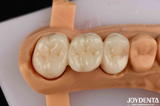 Mua Sức mạnh uốn cong cao Full Contour Zirconia cho vương miện Cầu phục hồi răng sản xuất trực tuyến