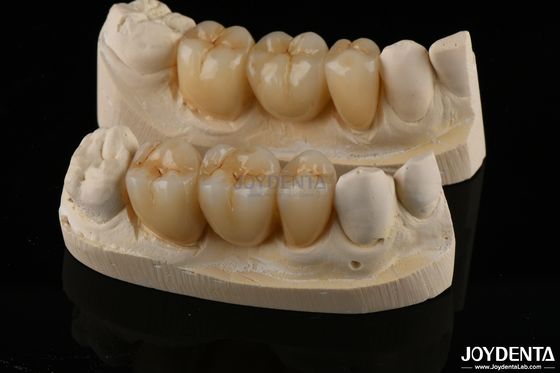 Mua Chống mài mòn Zirconia Full Contour Vương miện răng xuyên suốt cao sản xuất trực tuyến