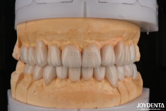 Mua Zirconia lớp xuyên suốt cao cho phục hồi răng đường viền đầy đủ sản xuất trực tuyến