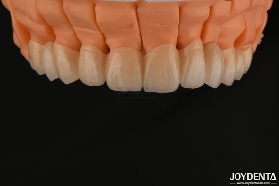 Mua Phong cách thẩm mỹ cao lớp Zirconia Vương miện đơn cầu cấy ghép để phục hồi răng sản xuất trực tuyến