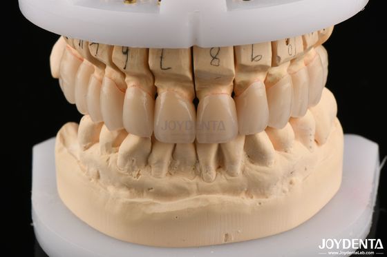 Mua bề mặt đánh bóng độ bền uốn cong Zirconia lớp cho cầu 6.0-6.1 G/cm3 mật độ sản xuất trực tuyến