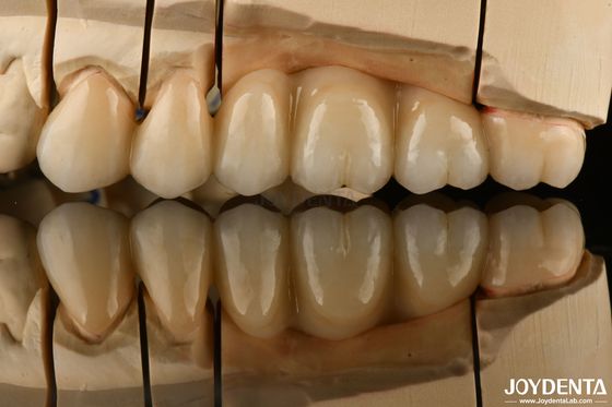 Mua Nhìn tự nhiên đa lớp Zirconia đầy đủ cho việc phục hồi răng cực xuyên suốt sản xuất trực tuyến