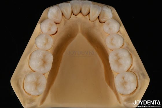 Mua 3D đa lớp nha khoa đầy đủ Zirconia chống vỡ cấu trúc răng tự nhiên sản xuất trực tuyến