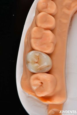 Mua răng đa lớp đầy đủ Zirconia vương miện và cầu cao xuyên suốt nhìn tự nhiên sản xuất trực tuyến
