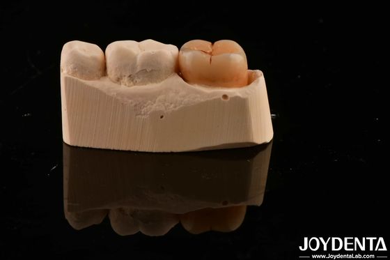 Mua Vật liệu phục hồi răng đa lớp Zirconia đầy đủ 1200 HV Dụng độ chống nứt sản xuất trực tuyến