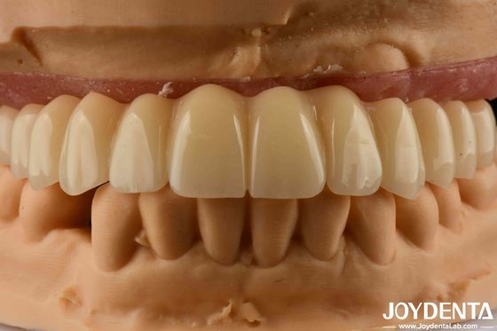 Mua Giải pháp nha khoa Ti-Base Zirconia Hybrid Bridge Tăng khả năng tương thích sinh học sản xuất trực tuyến