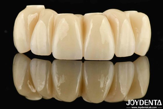 Mua Phục hồi răng Ti-Base Zirconia Hybrid Bridge trông tự nhiên sản xuất trực tuyến