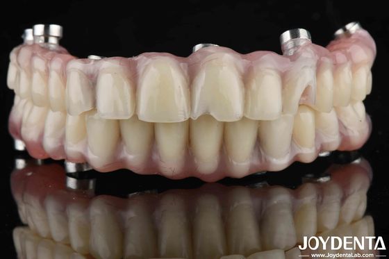 Mua Nhìn tự nhiên phòng thí nghiệm nha khoa răng Acrylic kết thúc cho sức đề kháng mòn cao sản xuất trực tuyến
