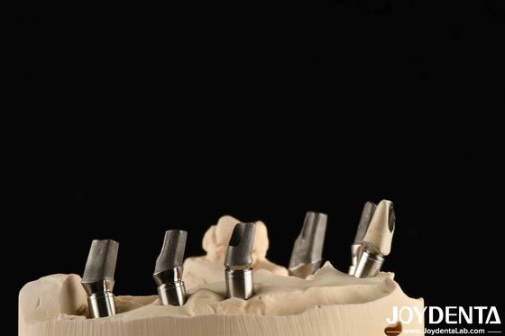 Mua Tiêu chuẩn được làm bằng Titanium đánh bóng Cement Retetion V-Shaped Thread sản xuất trực tuyến