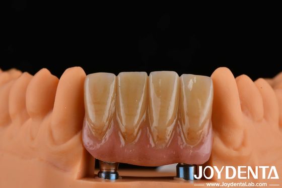 Mua 4.5mm chiều cao kết thúc Abutments nội bộ Hex kết nối loại tương thích với hệ thống cấy ghép sản xuất trực tuyến