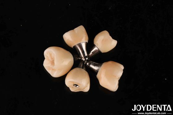 Mua Vòng vít giữ Titanium Abutments Internal Hex Connection cho cấy ghép răng sản xuất trực tuyến