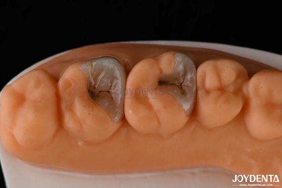 Mua Các lớp nhựa kết hợp và các lớp nhựa kết hợp để phục hồi răng sản xuất trực tuyến