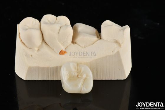 Mua Đồ đạc và Onlays Zirconia Tái thiết kế phù hợp cho sự phù hợp và thẩm mỹ không sánh kịp sản xuất trực tuyến