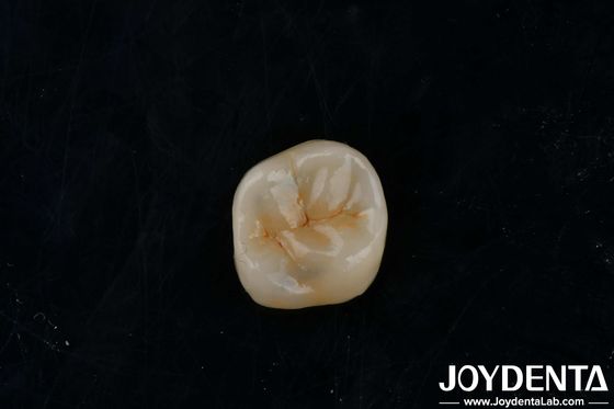 Mua Đen có thể tùy chỉnh Zirconia Inlays Onlays cao độ xuyên suốt để phục hồi sản xuất trực tuyến