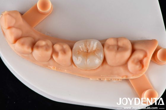 Mua Bảng đĩa Zirconia trong suốt cho Inlay Onlay Crown Restorations And Bridge Frame sản xuất trực tuyến
