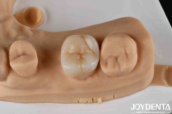 Mua Các lớp đệm và lớp đệm răng bằng Zirconia có độ bền cao để phục hồi răng sản xuất trực tuyến