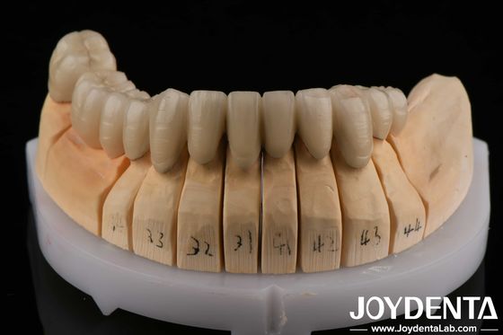 Mua Đồng kim cương vàng PFM kim cương hợp kim kim loại nha khoa tương thích với lớp porcelain sản xuất trực tuyến