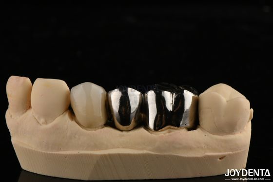 Mua Vương miện hợp kim kim loại chống mài mòn cho phục hồi răng tùy chỉnh sản xuất trực tuyến