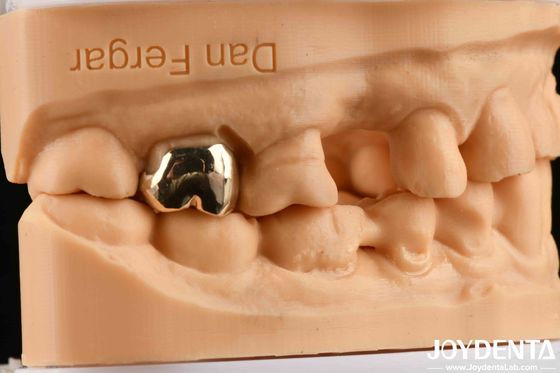 Mua Chất liệu nha khoa đúc sáp chống mài mòn để cải thiện phục hồi chức năng răng miệng sản xuất trực tuyến