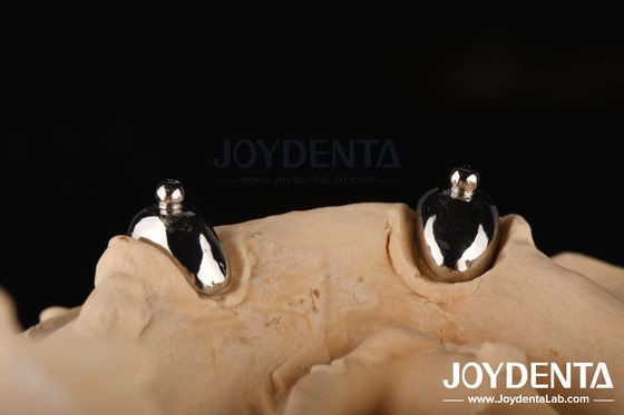 Mua Joydental phòng thí nghiệm nha khoa Ball đính kèm sản xuất trực tuyến