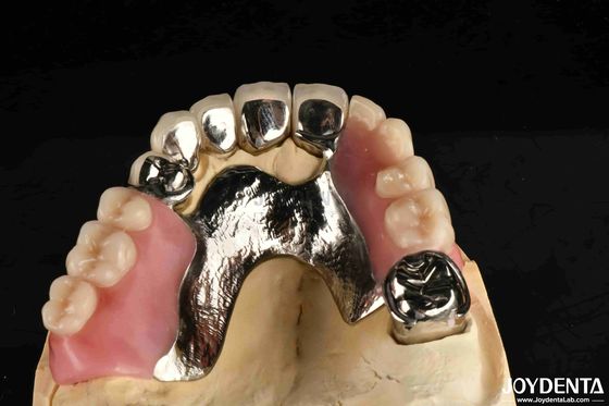 Mua Xây dựng khung thiết lập cuối cùng cấu trúc răng ổn định thiết kế răng kết thúc sản xuất trực tuyến