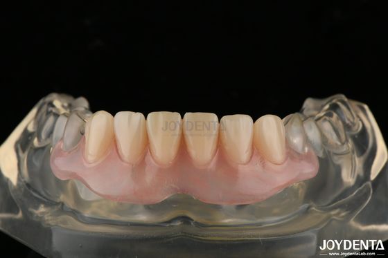 Mua Mẫu răng giả vô hình cá nhân được hoàn thiện bằng công nghệ sắp xếp răng tiên tiến sản xuất trực tuyến
